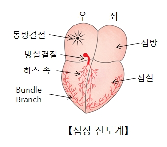 심방세동